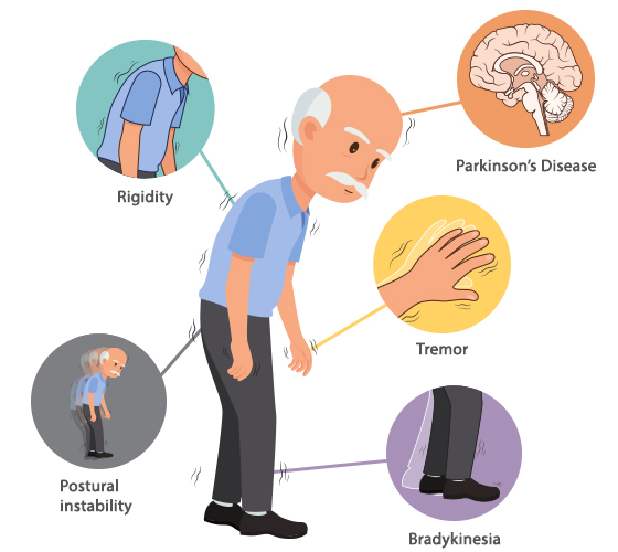 parkinsons disease nursing diagnosis impaired physical mobility